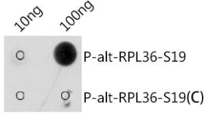 Dot blot analysis of a mixture of peptides using Anti-alt-RPL36 (phospho Ser19) Antibody (A305753) at a 1:1,000 dilution Exposure time: 30s