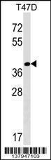 Anti-NTAN1 Rabbit Polyclonal Antibody (AP (Alkaline Phosphatase))