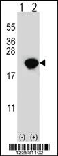 Anti-PIN1 Rabbit Polyclonal Antibody