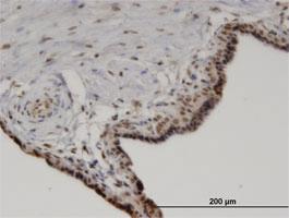 Anti-PPM1A Mouse Monoclonal Antibody [clone: 4E11]