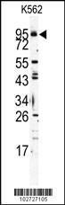 Anti-TLR6 Rabbit Polyclonal Antibody (Biotin)