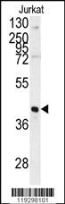 Anti-RORC Rabbit Polyclonal Antibody