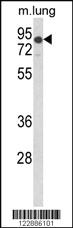 Anti-LDLR Rabbit Polyclonal Antibody