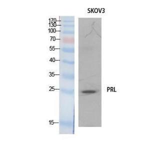 Western blot analysis of extracts from SKOV3 cells using Anti-PRL Antibody