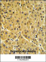 Anti-RORC Rabbit Polyclonal Antibody