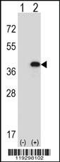 Anti-RORC Rabbit Polyclonal Antibody