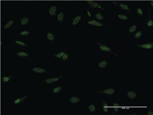 Anti-PPM1A Mouse Monoclonal Antibody [clone: 4E11]