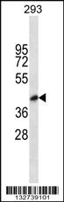 Anti-BVES Rabbit Polyclonal Antibody