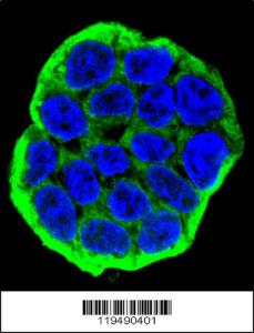 Anti-CTND1 Rabbit Polyclonal Antibody (FITC (Fluorescein Isothiocyanate))