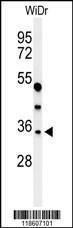 Anti-MAFA Rabbit Polyclonal Antibody