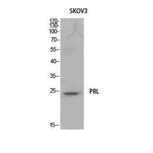 Western blot analysis of SKOV3 cells using Anti-PRL Antibody