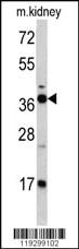 Anti-FBP1 Rabbit Polyclonal Antibody