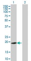 Anti-ZNF26 Mouse Polyclonal Antibody