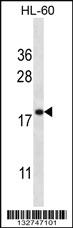 Anti-TMEM70 Rabbit Polyclonal Antibody