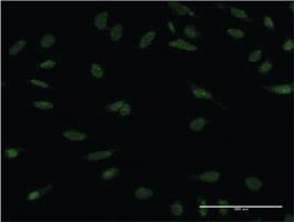 Anti-PPM1A Mouse Monoclonal Antibody [clone: 4E11]