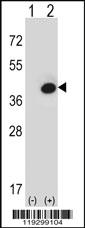 Anti-FBP1 Rabbit Polyclonal Antibody