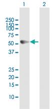 Anti-CK83 Rabbit Polyclonal Antibody