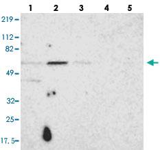 Anti-UPF3B Rabbit Polyclonal Antibody