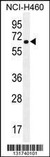 Anti-CHRND Rabbit Polyclonal Antibody (APC (Allophycocyanin))