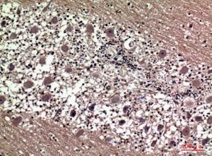 Immunohistochemical analysis of paraffin-embedded human brain using Anti-PRL Antibody