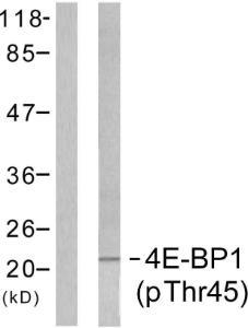 Western blot analysis of lysates from MDA-MB-435 cells treated with EGF 200ng/ml 5' using Anti-4E-BP1 (phospho Thr45) Antibody. The right hand lane represents a negative control, where the antibody is blocked by the immunising peptide.