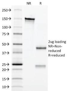 SDS-PAGE analysis of Anti-EPO Antibody [EPO/1367] under non-reduced and reduced conditions; showing intact IgG and intact heavy and light chains, respectively. SDS-PAGE analysis confirms the integrity and purity of the antibody