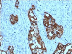 Immunohistochemical analysis of formalin-fixed, paraffin-embedded human colon using Anti-TROP2 Antibody [rTACSTD2/6397]