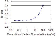 Anti-PPM1A Mouse Monoclonal Antibody [clone: 4E11]