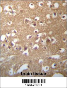 Anti-TMCC3 Rabbit Polyclonal Antibody (Biotin)