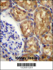 Anti-ASS1 Rabbit Polyclonal Antibody (HRP (Horseradish Peroxidase))