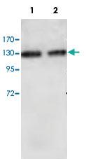 Anti-RBBP6 Rabbit Polyclonal Antibody