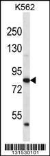 Anti-ABTB2 Rabbit Polyclonal Antibody (FITC (Fluorescein Isothiocyanate))