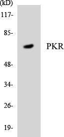 Western blot analysis of the lysates from COLO205 cells using Anti-PKR Antibody