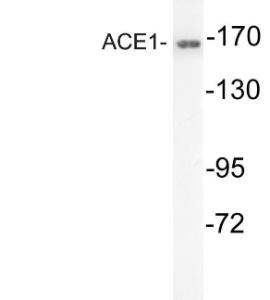 Western blot analysis of lysates from mouse kidney using Anti-ACE1 Antibody