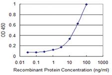 Anti-L1CAM Mouse Monoclonal Antibody [clone: 3B10]