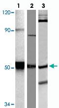 Anti-FYN Rabbit Polyclonal Antibody