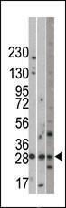 Anti-UBR5 Rabbit Polyclonal Antibody (Biotin)