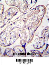 Anti-PYCR2 Rabbit Polyclonal Antibody (FITC (Fluorescein Isothiocyanate))