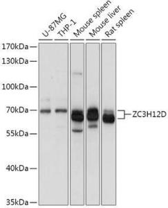 Western blot analysis of extracts of various cell lines, using Anti-ZC3H12D Antibody (A308326) at 1:1,000 dilution. The secondary antibody was Goat Anti-Rabbit IgG H&L Antibody (HRP) at 1:10,000 dilution.