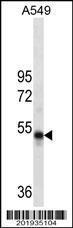 Anti-RUVBL1 Mouse Monoclonal Antibody (AP (Alkaline Phosphatase)) [clone: 507CT2.2.2]