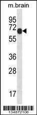 Anti-PXK Rabbit Polyclonal Antibody (APC (Allophycocyanin))