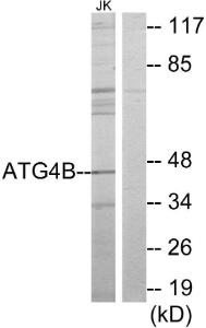 Western blot analysis of lysates from Jurkat cells using Anti-ATG4B Antibody. The right hand lane represents a negative control, where the antibody is blocked by the immunising peptide