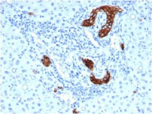 Immunohistochemical analysis of formalin-fixed, paraffin-embedded human colon using Anti-TROP2 Antibody [rTACSTD2/6397]