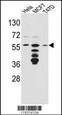 Anti-FKBP4 Rabbit Polyclonal Antibody