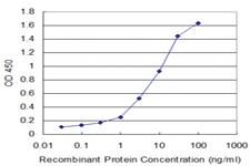 Anti-LAD1 Mouse Monoclonal Antibody [clone: 2A9]