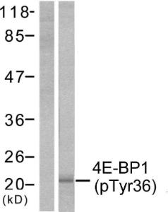 Western blot analysis of lysates from MDA-MB-435 cells treated with EGF 200 ng/ml 30' using Anti-4E-BP1 (phospho Thr36) Antibody. The left hand lane represents a negative control, where the Antibody is blocked by the immunising peptide