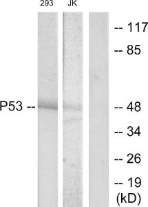 Western blot analysis of lysates from 293 and Jurkat cells, treated with UV using Anti-p53 Antibody. The right hand lane represents a negative control, where the antibody is blocked by the immunising peptide