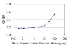 Anti-TRIM25 Polyclonal Antibody Pair