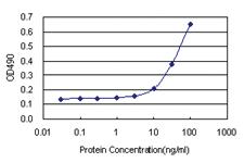 Anti-MMP3 Antibody Pair