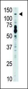 Anti-TLR7 Rabbit Polyclonal Antibody (AP (Alkaline Phosphatase))